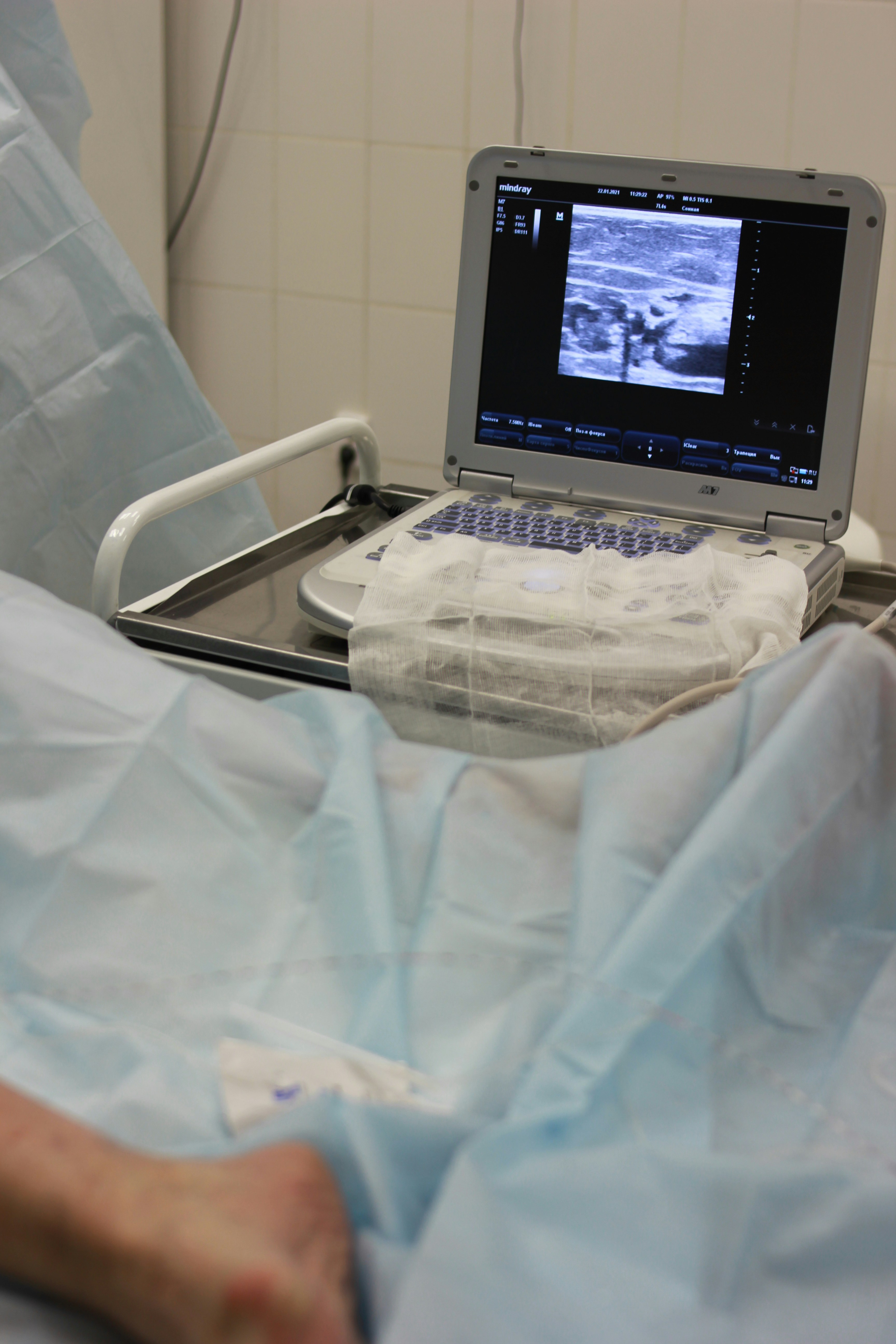 Diagnostic scan equipment at Mariland Medical centre