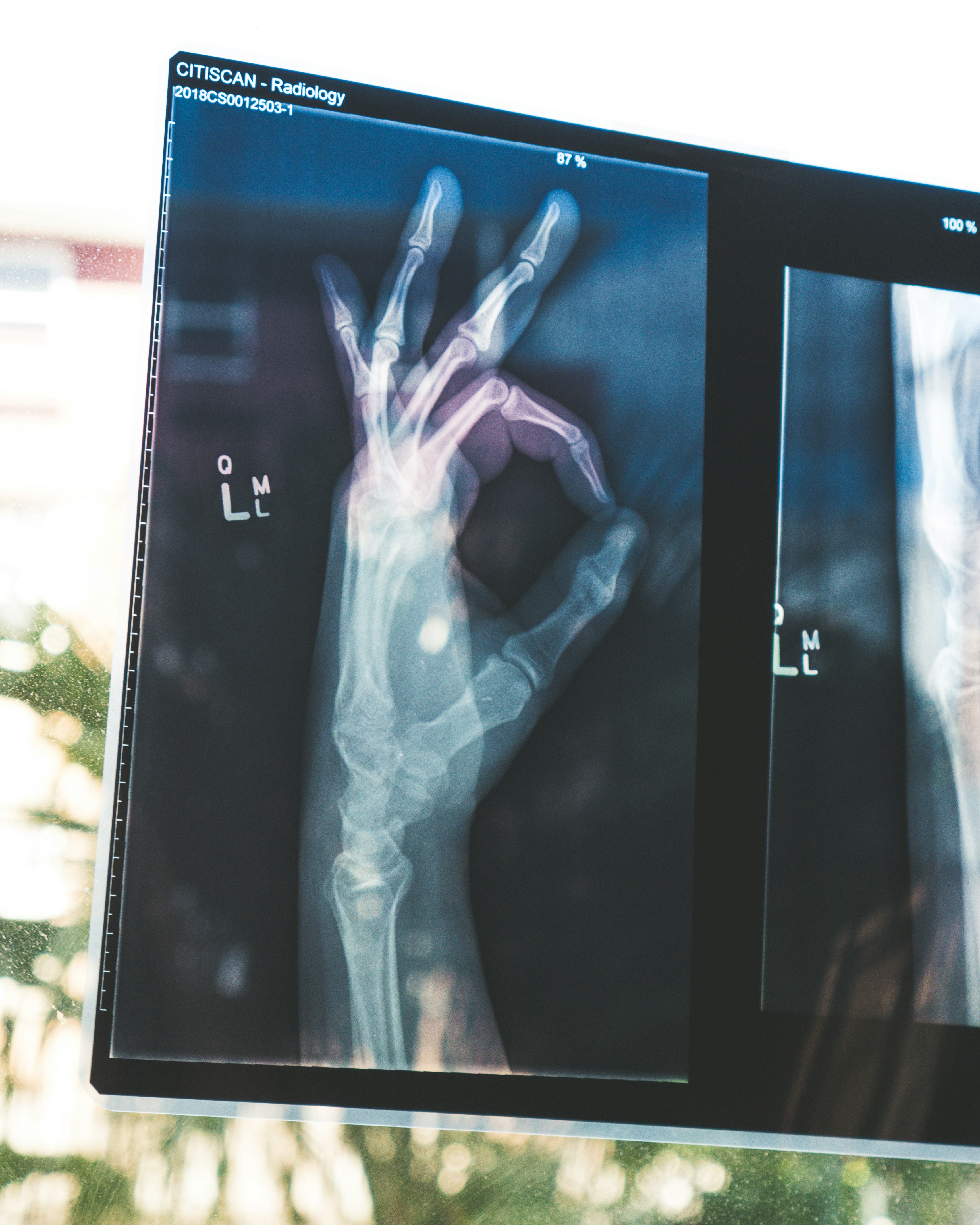 Xray imaging at Mariland Medical centre